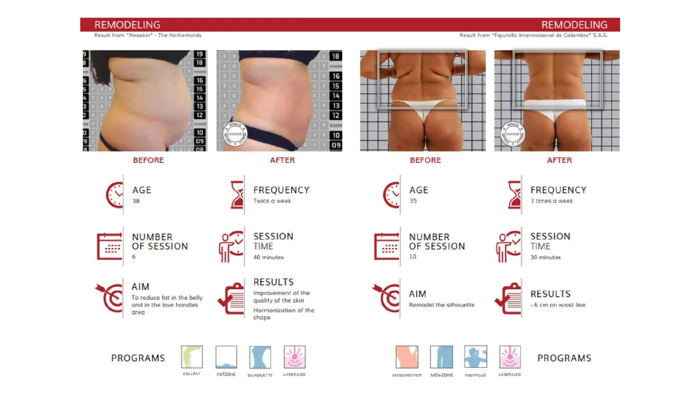 icoone® before and after — body remodelling, with session data
