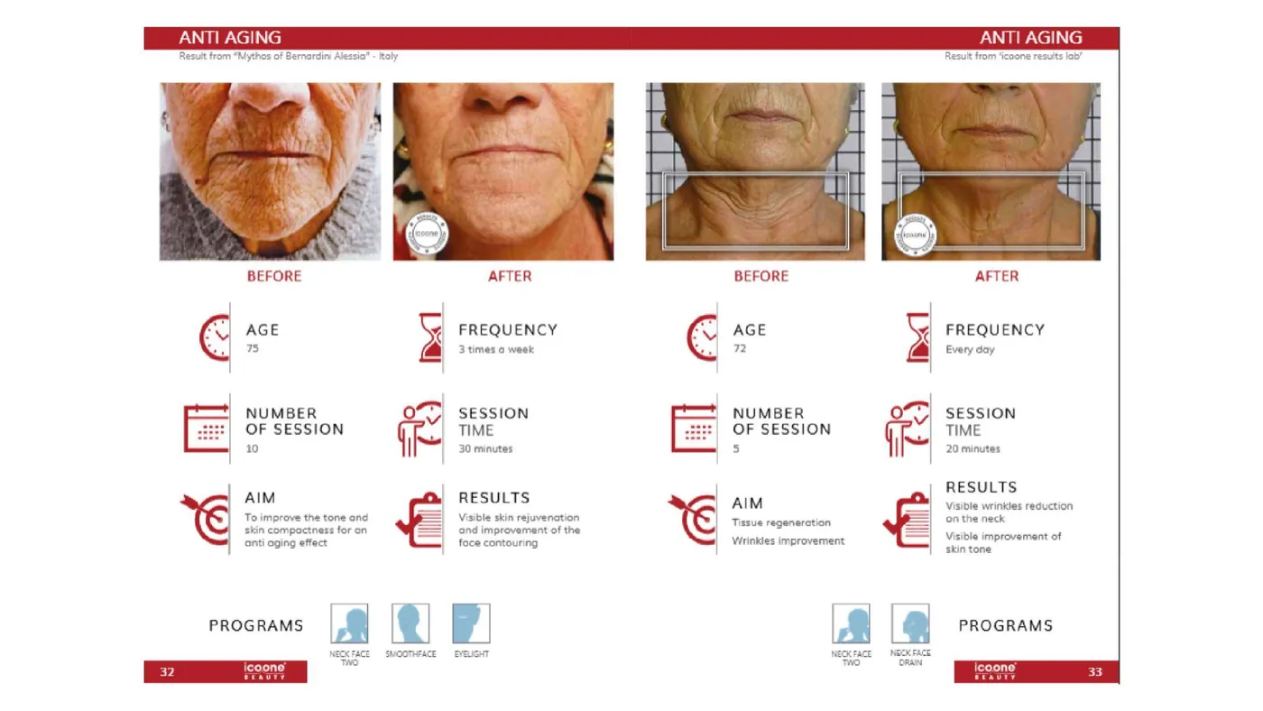 Face anti-ageing — documented case