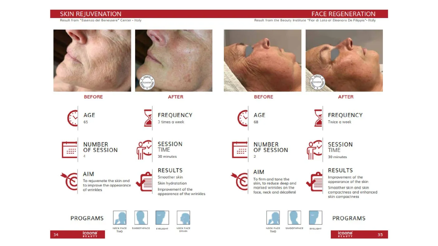 Skin rejuvenation — documented case