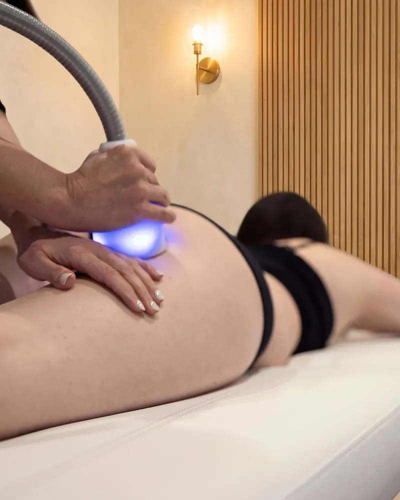 Cryoskin® Revolution wand session on the glutes and back of the thigh